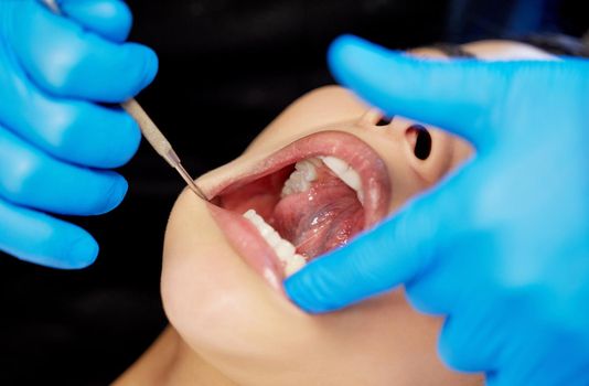 a young woman having a dental procedure performed on her.