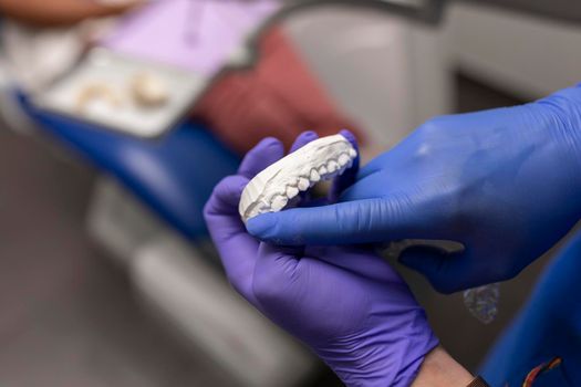 A dentist woman's hands holding and pointing a plaster denture of one of her clients at the dental clinic