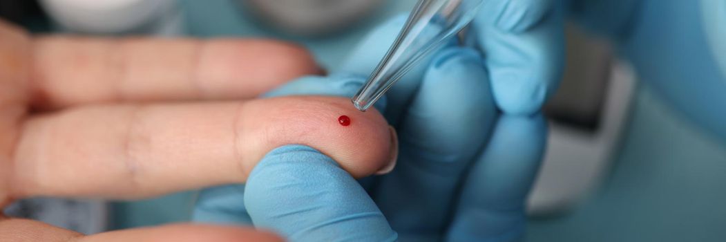 Close-up of doctor take blood of client finger with glass tube, usual procedure at clinic. Planned test for client on appointment. Medicine, clinic concept