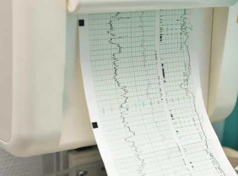 Monitor for measuring contractions and heartbeat of a pregnant woman