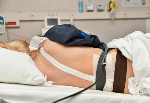 The woman lies in the birthplace with contractions and epidural anesthesia