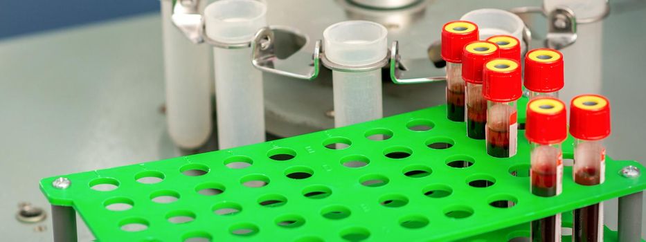 Test tubes with blood samples in rack and in centrifuge machine in the lab