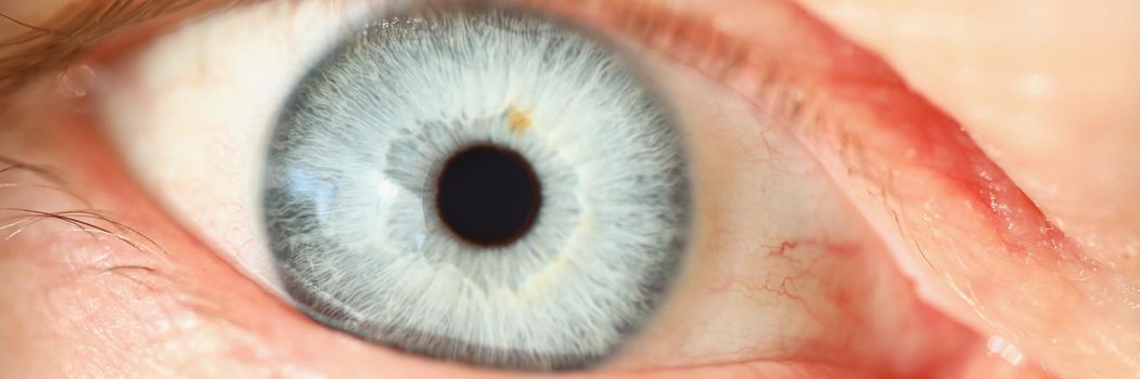 Close-up of light blue human eye colour, extreme macro shot of persons vision, capillaries eyelashes and imperfection. Ophthalmology, aging changes concept