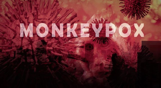 Monkeypox outbreak concept. Monkeypox is caused by monkeypox virus. Monkeypox is a viral zoonotic disease. Virus transmitted to humans from animals. Monkeys may harbor the virus and infect people.