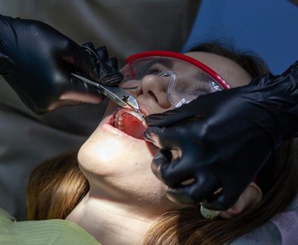 The process of removing braces. A beautiful woman in protective glasses in a dental chair during the procedure of removing braces from teeth. Dentist and assistant working.