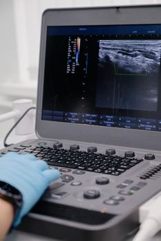 The doctor uses an ultrasound device to study the condition of the veins.Modern ultrasound monitor. Ultrasonography machine. High technology medical and healthcare equipment.