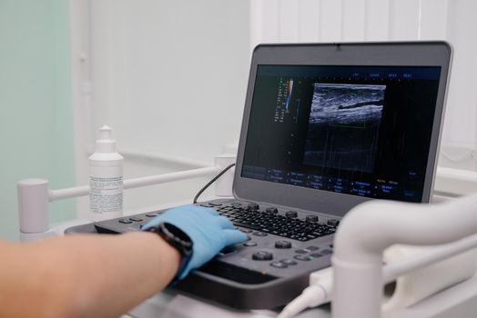 The doctor uses an ultrasound device to study the condition of the veins.Modern ultrasound monitor. Ultrasonography machine. High technology medical and healthcare equipment.