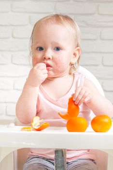 Cute child toddler with food allergy on face. High quality photo