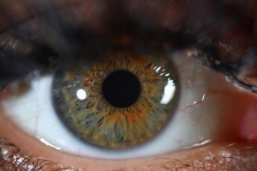 Detail of human eye with gray green iris. Eye diseases and laser vision correction concept