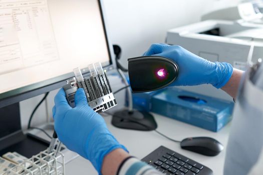 Hands with gloves of a person scanning vessel reaction in a laboratory of an hospital