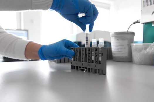 Close up view of a hospital laboratory technician sorting samples in a centrifuge reaction vessel