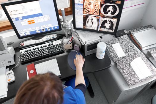 Top view of a doctor examining the images of a tomography in the hospital