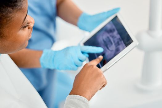 Im so proud of far Ive come. a young woman looking over her dental x-rays with her doctor using a tablet