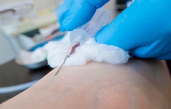 Close up nurse pricking needle syringe in the arm patient drawing blood sample for blood test