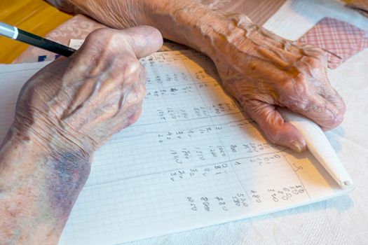 A bruise after an unsuccessful fall on the hands of an elderly man. Old age. wrinkled skin. an elderly woman with bruises on her hands is playing cards, keeping score. write the score in a card game