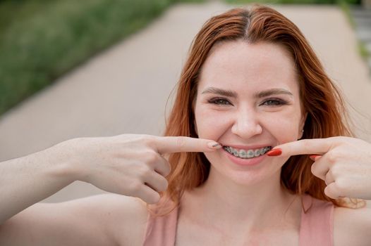 Young red-haired woman with braces on her teeth point to a smile outdoors in summer.
