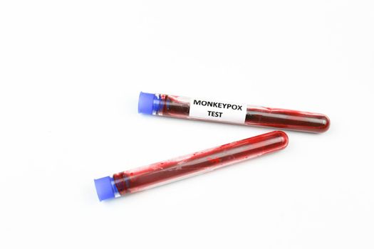 Test tubes filled with blood for Monkeypox on white background