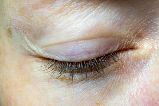 Woman's closed eye close-up. Problematic skin near the eye. Clouse up.