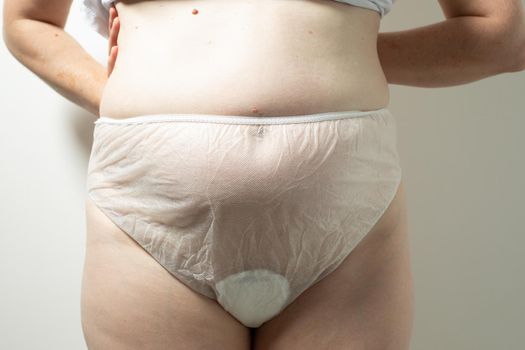 Female postpartum belly in disposable underpants, concept of postpartum recovery