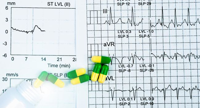 Green-yellow capsule pills spread out of white plastic drug bottle on EKG or ECG graph report paper. Medicine effect on cardiac function. Heart medication concept. Pharmacology. Prescription drugs.