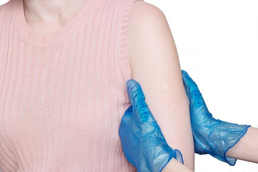 Doctor or nurse examine two tuberculosis vaccine BCG marks on the shoulder of an adult woman made in childhood