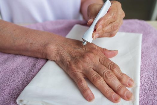 close-up, hands of elderly woman with wrinkles and arthritis. warming, healing cream for the treatment of joints with age-related changes in the elderly. The concept of medicine, disease prevention