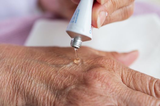 Close-up, wrinkled hands of old woman on a light background an elderly woman treats her hands for dermatitis, eczema and other age-related skin problems, the concept of medicine and disease prevention