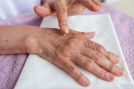 Close-up, the hands of an elderly woman on a light background. An old woman rubs a medicinal joint ointment into her skin to prevent and treat joint diseases. Concept of preventive medicine
