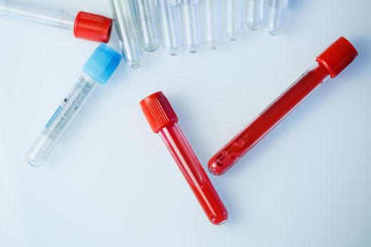 Test tubes for blood analysis. Check for the virus. Medical Devices