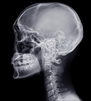 Skull x-ray image of Human name is skull lateral view isolated on Black Background.