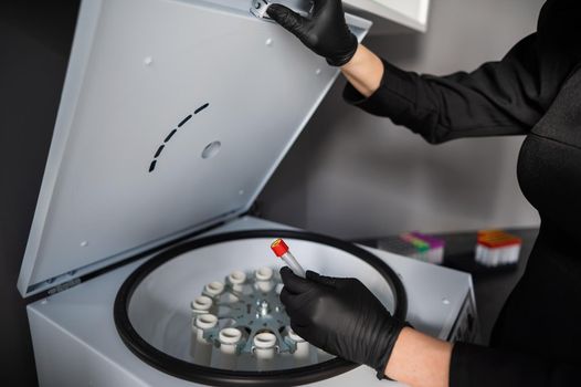 The doctor takes out a test tube with blood plasma from the centrifuge. Plasma lifting procedure for skin rejuvenation