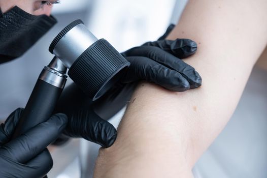 A dermatologist examines a patient's mole through a dermatoscope
