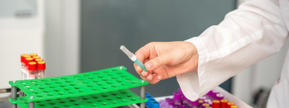 Female doctor's hands prepare tools for blood sampling in the lab