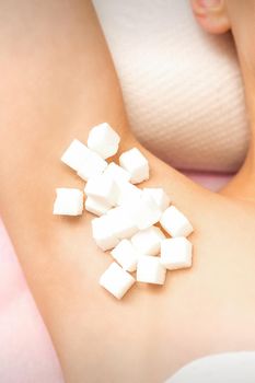 Sugaring concept. White sugar cubes lying on the armpit of a young female