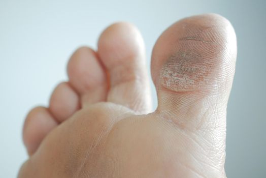 close up of young men dry feet on bed
