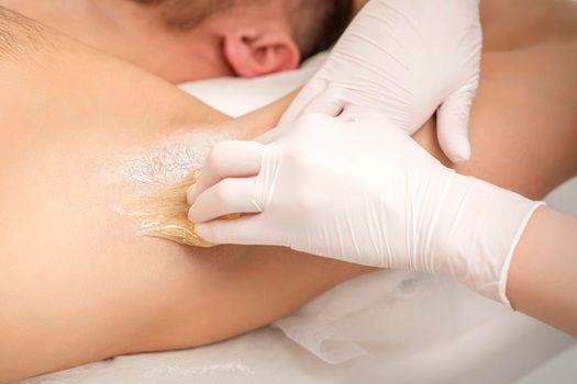 Close up of hands in gloves of beautician waxing young male armpit with sugar paste in hair removal salon