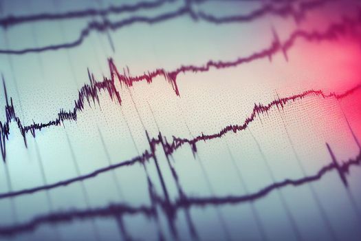 Electrocardiogram, EKG, heart rate monitor showing a specific illness in hospital room for checking heart rate hospitalized patients