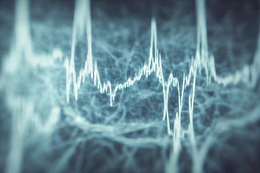 Electrocardiogram, EKG, heart rate monitor showing a specific illness in hospital room for checking heart rate hospitalized patients