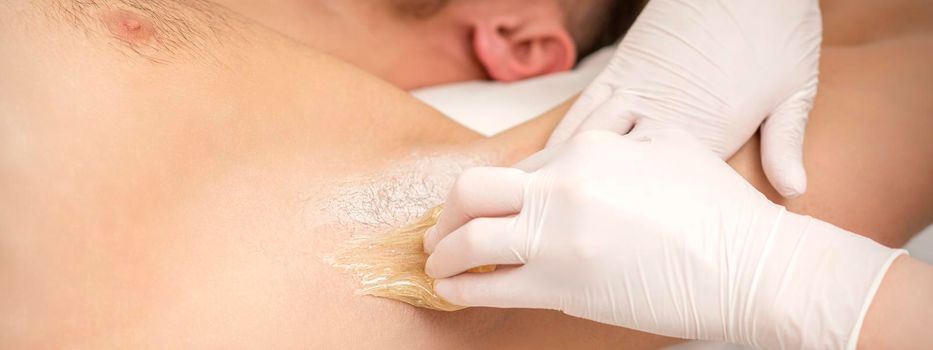 Close up of hands in gloves of beautician waxing young male armpit with sugar paste in hair removal salon