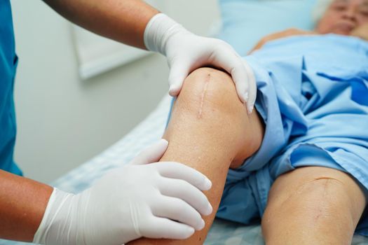 Doctor checking Asian elderly woman patient with scar knee replacement surgery in hospital.