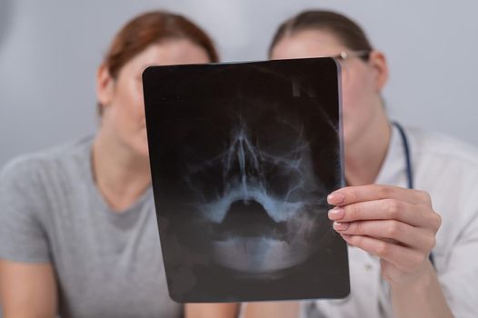 A woman doctor and a patient at the reception are discussing an x-ray of the sinuses