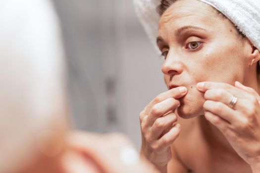 A caucasian adult woman looking in the mirror and squeezing a pimple after a shower at a hotel. Concept of skin care.