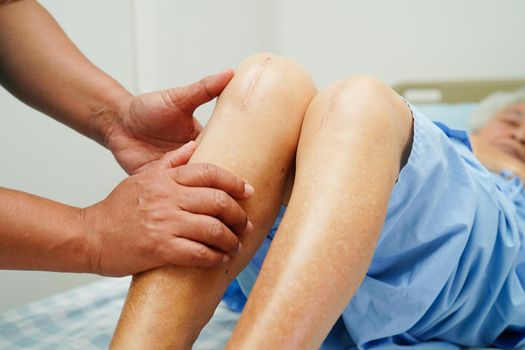 Doctor checking Asian elderly woman patient with scar knee replacement surgery in hospital.