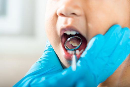 Dental kid health examination. Doctor examines oral cavity of little child uses mouth mirror to checking teeth cavity, Asian dentist making examination procedure for smiling cute little girl