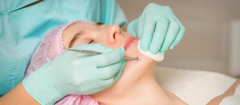 Facial cleansing. Blackhead Removal Tool. Beautician removing blackhead and acne on female chin in a beauty salon