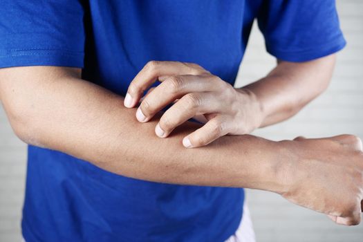 man suffering from itching skin, close up