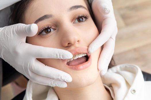 Orthodontist checking brackets on female teeth. Concept of stomatology, dentistry, orthodontic treatment