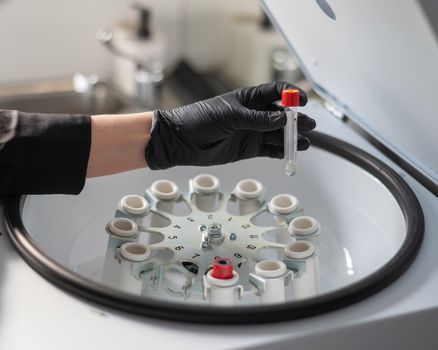 The doctor takes out a test tube with blood plasma from the centrifuge. Plasma lifting procedure for skin rejuvenation