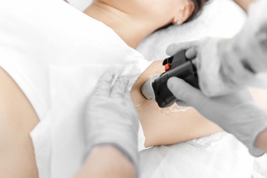 the process of laser hair removal close-up. Underarm hair removal laser close-up.