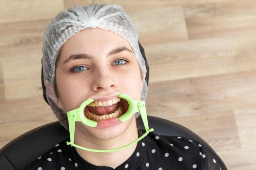 Patient with cheek retractor lying in dentist office in modern clinic